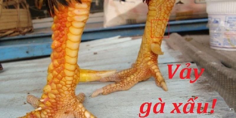 Nguyên nhân chính của vảy gà xấu là sự tích tụ của tế bào da chết